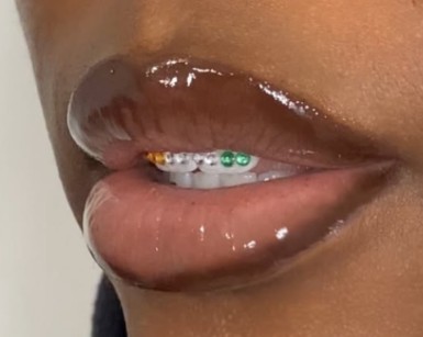 Strass dentaire — miniature 3